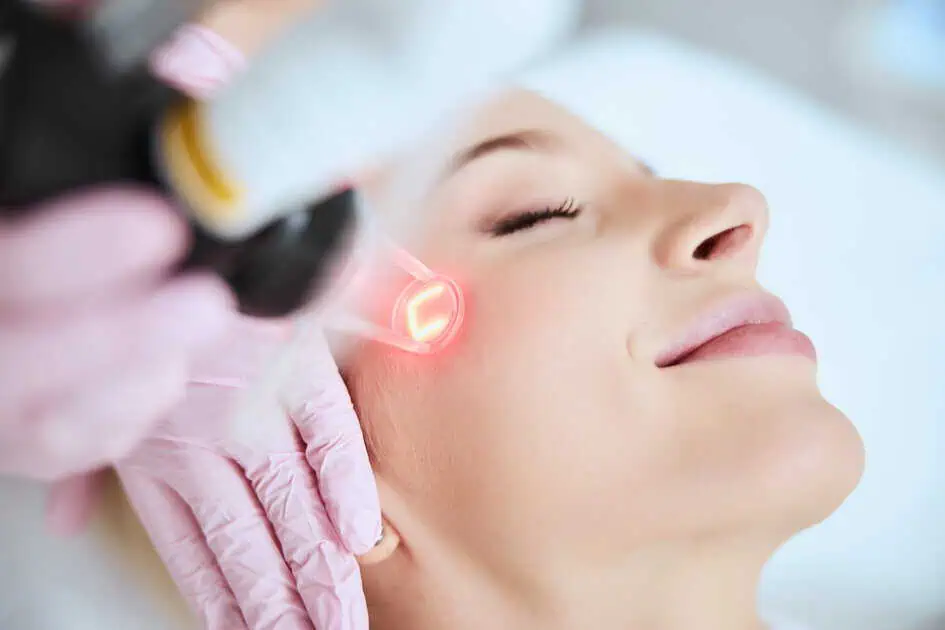 Deka CO2 laser Treatment by Bella Rose Aesthetics in Carmel Indiana