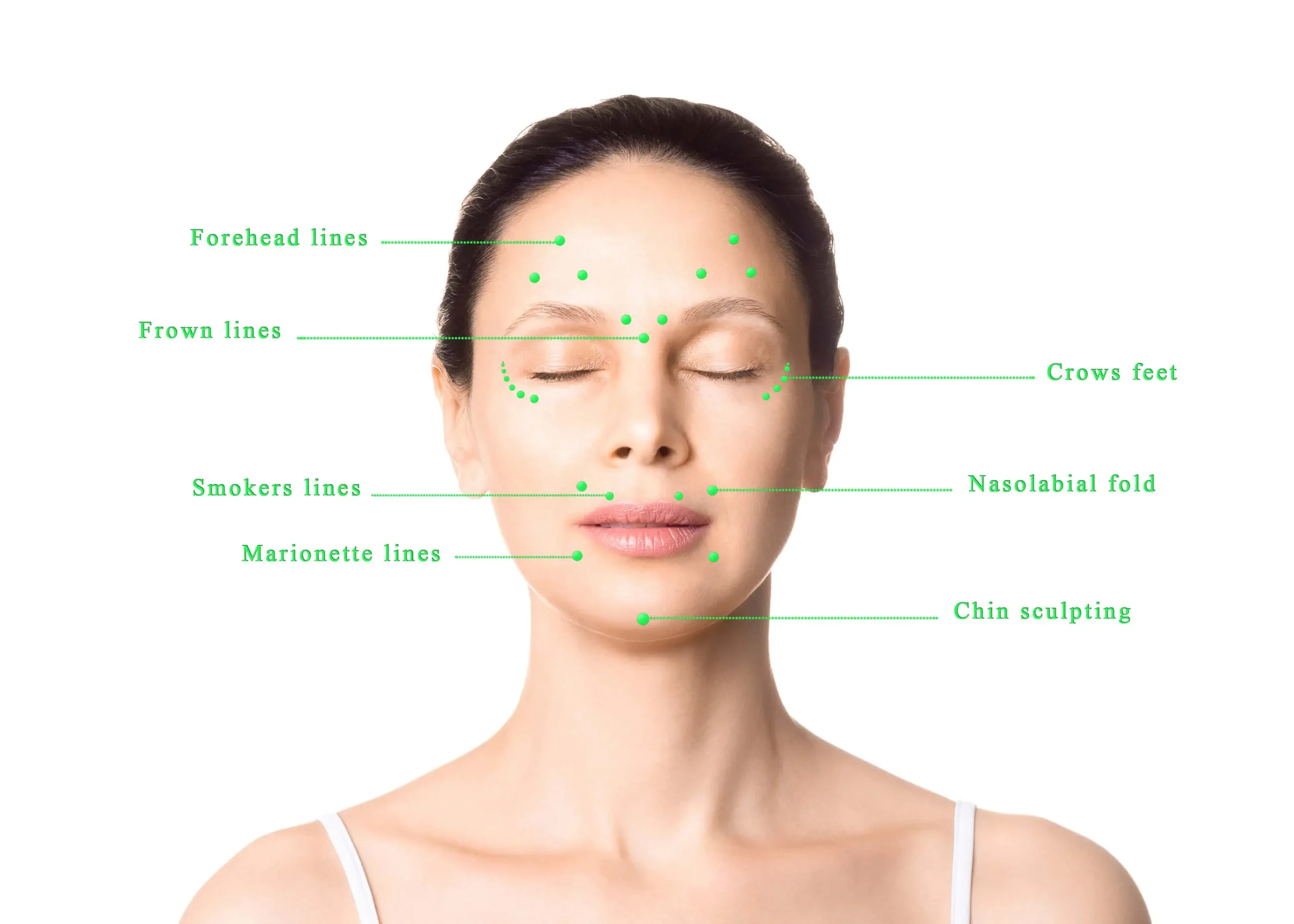 Dysport Treatment in Carmel Indiana | Bella Rose Aesthetics