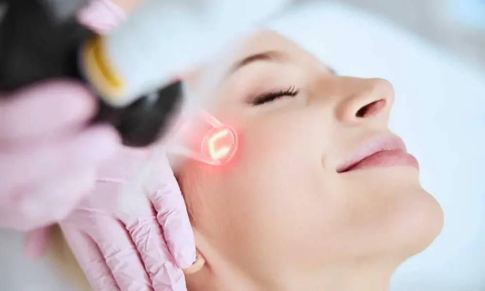 Deka CO2 laser Treatment by Bella Rose Aesthetics in Carmel Indiana