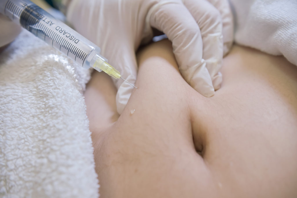Lipolysis Purpose, Procedure, and Side Effects
