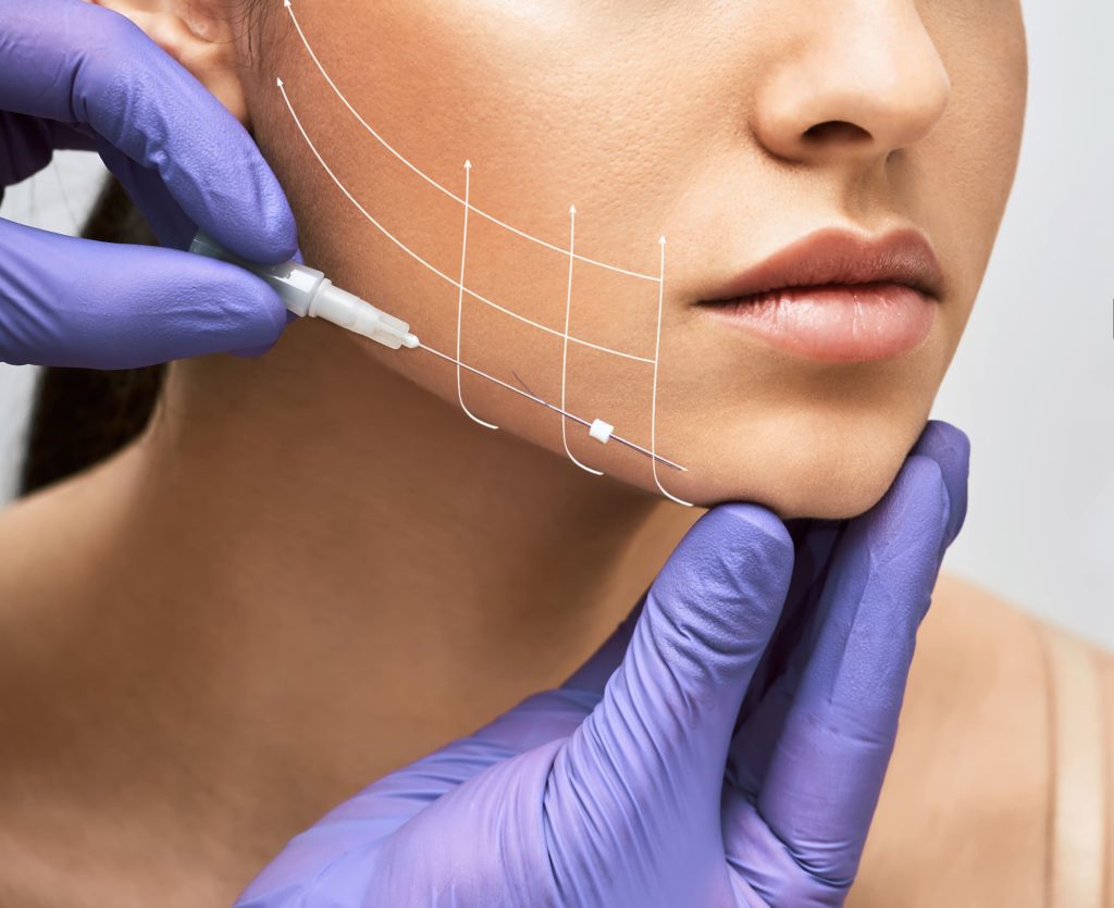 What is Thread Lift? Is It Like Other Facelifts? Bella Rose Aesthetics