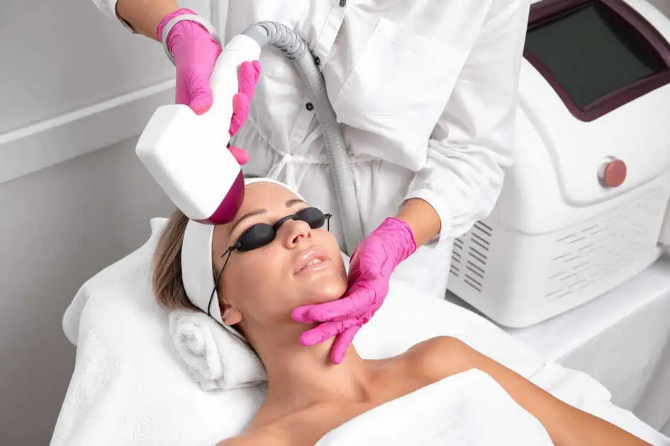 CoolPeel Laser Treatment in Carmel IN by Bella Rose Aesthetics