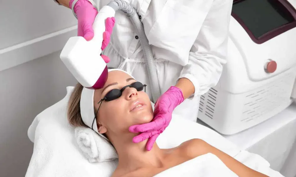 CoolPeel Laser Treatment in Carmel IN by Bella Rose Aesthetics