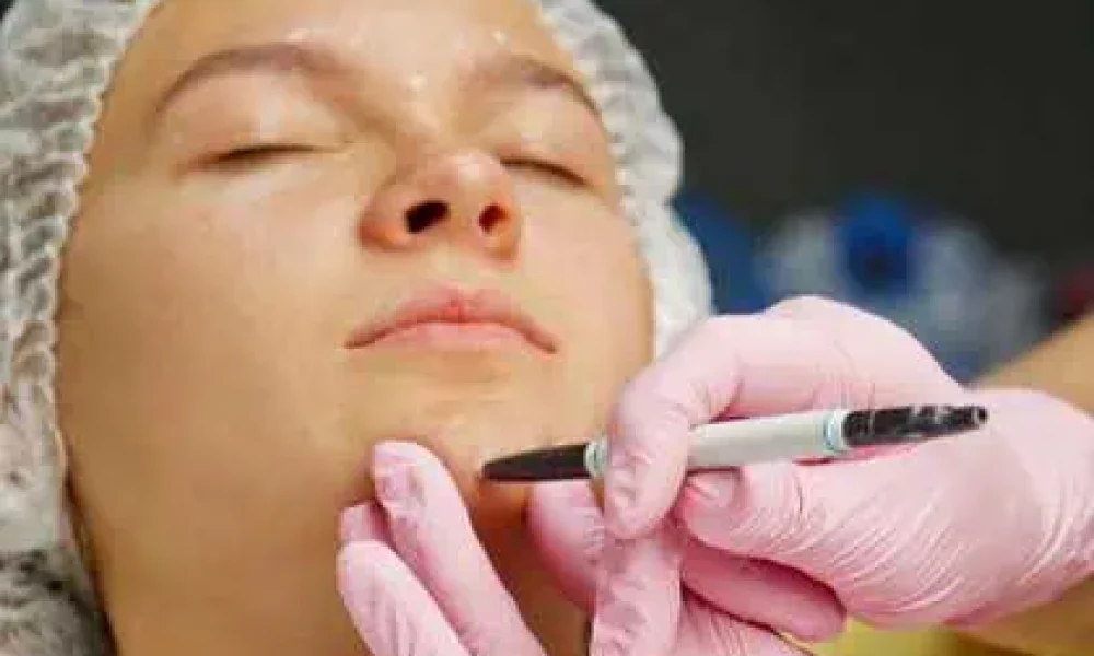 Women Receiving Kybella Treatment in Carmel In | Bella Rose Aesthetic