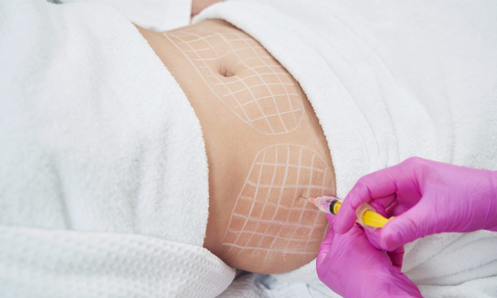 What are LipolyticFat-Dissolving Treatments and Their Benefits