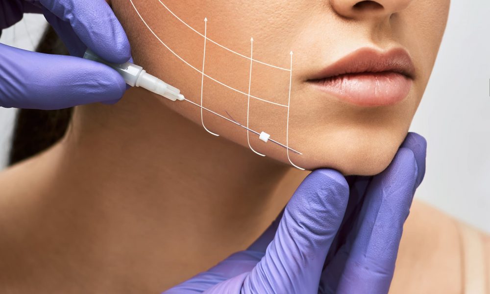 What is Thread Lift? Is It Like Other Facelifts? Bella Rose Aesthetics